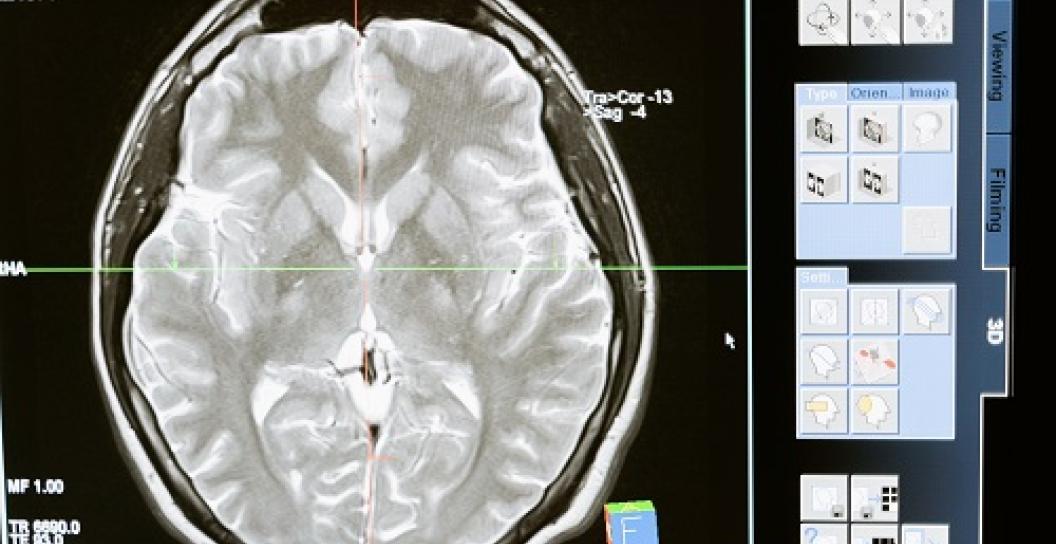 CAT scan or MRI of brain